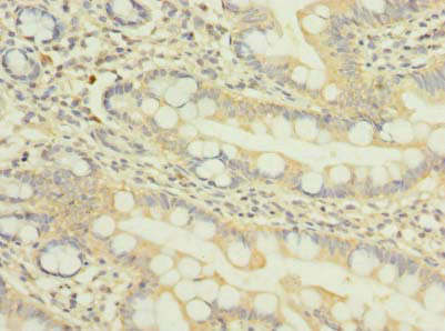 Immunohistochemistry of paraffin-embedded human small intestine tissue using NUP58 Antibody at dilution of 1:100Rabbit anti-Human NUP58 Polyclonal Antibody
