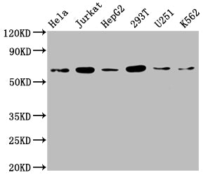 Western Blot | Positive WB detected in: Hela whole cell lysate, Jurkat whole cell lysate, HepG2 whole cell lysate, 293T whole cell lysate, U251 whole cell lysate, K562 whole cell lysate | All lanes: NUP58 antibody at 1:2000 | Secondary | Goat polyclonal to rabbit IgG at 1/50000 dilution | Predicted band size: 61, 51, 60 kDa | Observed band size: 65 kDaRabbit anti-Human NUP58 Polyclonal Antibody