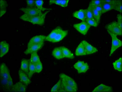 Immunofluorescence staining of HepG2 cells with RIOK2 Antibody at 1:133, counter-stained with DAPI. The cells were fixed in 4% formaldehyde, permeabilized using 0.2% Triton X-100 and blocked in 10% normal Goat Serum. The cells were then incubated with the antibody overnight at 4°C. The secondary antibody was Alexa Fluor 488-congugated AffiniPure Goat Anti-Rabbit IgG(H+L).Rabbit anti-Human RIOK2 Polyclonal Antibody