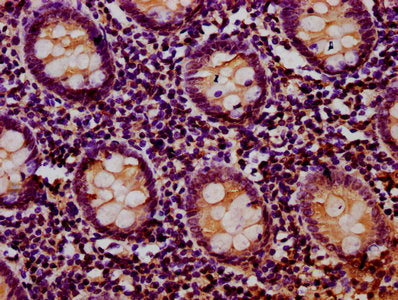 IHC image of RIOK2 Antibody diluted at 1:400 and staining in paraffin-embedded human appendix tissue performed on a Leica BondTM system. After dewaxing and hydration, antigen retrieval was mediated by high pressure in a citrate buffer (pH 6.0). Section was blocked with 10% normal goat serum 30min at RT. Then primary antibody (1% BSA) was incubated at 4°C overnight. The primary is detected by a biotinylated secondary antibody and visualized using an HRP conjugated SP system.Rabbit anti-Human RIOK2 Polyclonal Antibody