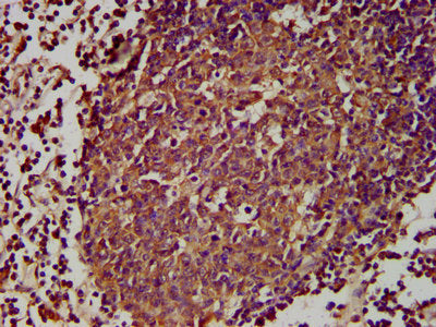 IHC image of GPR174 Antibody diluted at 1:300 and staining in paraffin-embedded human lymph node tissue performed on a Leica BondTM system. After dewaxing and hydration, antigen retrieval was mediated by high pressure in a citrate buffer (pH 6.0). Section was blocked with 10% normal goat serum 30min at RT. Then primary antibody (1% BSA) was incubated at 4°C overnight. The primary is detected by a biotinylated secondary antibody and visualized using an HRP conjugated SP system.Rabbit anti-Human GPR174 Polyclonal Antibody