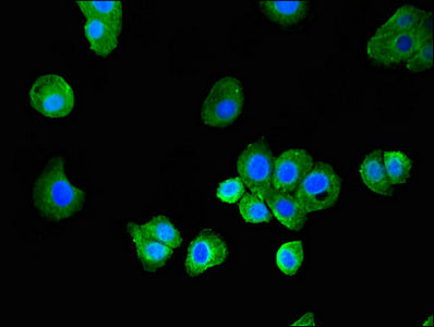Immunofluorescent analysis of HepG2 cells using MAP1LC3C Antibody at dilution of 1:100 and Alexa Fluor 488-congugated AffiniPure Goat Anti-Rabbit IgG(H+L)