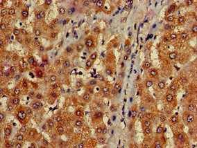 Immunohistochemistry of paraffin-embedded human liver tissue using MAP1LC3C Antibody at dilution of 1:100