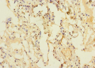Immunohistochemistry of paraffin-embedded human lung tissue using DUSP16 Antibody at dilution of 1:100Rabbit anti-Human DUSP16 Polyclonal Antibody