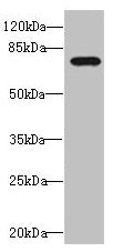 Western blot  | All lanes: DUSP16 antibody at 1.69µg/ml + 293T whole cell lysate  | Secondary  | Goat polyclonal to rabbit IgG at 1/10000 dilution  | Predicted band size: 74, 17 kDa  | Observed band size: 74 kDaRabbit anti-Human DUSP16 Polyclonal Antibody