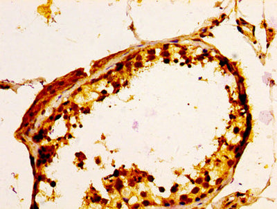 IHC image of the antibody diluted at 1:100 and staining in paraffin-embedded human testis tissue performed on a Leica BondTM system. After dewaxing and hydration, antigen retrieval was mediated by high pressure in a citrate buffer (pH 6.0). Section was blocked with 10% normal goat serum 30min at RT. Then primary antibody (1% BSA) was incubated at 4°C overnight. The primary is detected by a biotinylated secondary antibody and visualized using an HRP conjugated SP system.Rabbit anti-Human ULBP1 Polyclonal Antibody