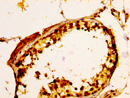 IHC image of the antibody diluted at 1:100 and staining in paraffin-embedded human testis tissue performed on a Leica BondTM system. After dewaxing and hydration, antigen retrieval was mediated by high pressure in a citrate buffer (pH 6.0). Section was blocked with 10% normal goat serum 30min at RT. Then primary antibody (1% BSA) was incubated at 4°C overnight. The primary is detected by a biotinylated secondary antibody and visualized using an HRP conjugated SP system.Rabbit anti-Human ULBP1 Polyclonal Antibody