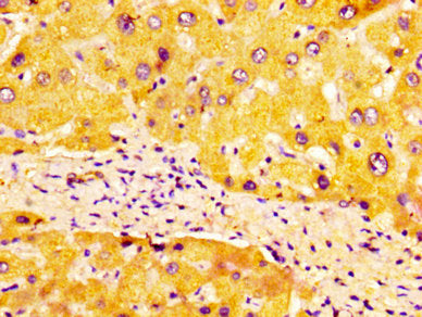 IHC image of ULBP1 Antibody diluted at 1:100 and staining in paraffin-embedded human liver tissue performed on a Leica BondTM system. After dewaxing and hydration, antigen retrieval was mediated by high pressure in a citrate buffer (pH 6.0). Section was blocked with 10% normal goat serum 30min at RT. Then primary antibody (1% BSA) was incubated at 4°C overnight. The primary is detected by a biotinylated secondary antibody and visualized using an HRP conjugated SP system.Rabbit anti-Human ULBP1 Polyclonal Antibody