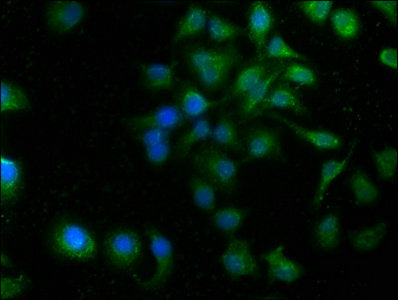 Immunofluorescence staining of A549 cells with PORCN Antibody at 1:100, counter-stained with DAPI. The cells were fixed in 4% formaldehyde, permeabilized using 0.2% Triton X-100 and blocked in 10% normal Goat Serum. The cells were then incubated with the antibody overnight at 4°C. The secondary antibody was Alexa Fluor 488-congugated AffiniPure Goat Anti-Rabbit IgG(H+L).Rabbit anti-Human PORCN Polyclonal Antibody
