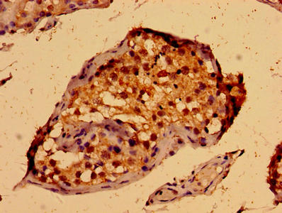 Immunohistochemistry of paraffin-embedded human testis tissue using PORCN Antibody at dilution of 1:100Rabbit anti-Human PORCN Polyclonal Antibody