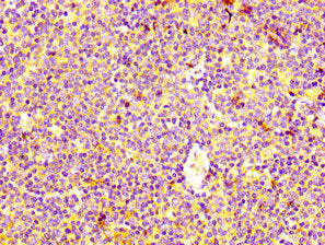 IHC image of HRH4 Antibody diluted at 1:400 and staining in paraffin-embedded human lymph node tissue performed on a Leica BondTM system. After dewaxing and hydration, antigen retrieval was mediated by high pressure in a citrate buffer (pH 6.0). Section was blocked with 10% normal goat serum 30min at RT. Then primary antibody (1% BSA) was incubated at 4°C overnight. The primary is detected by a biotinylated secondary antibody and visualized using an HRP conjugated SP system.Rabbit anti-Human HRH4 Polyclonal Antibody