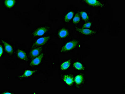 Immunofluorescent analysis of A549 cells using WNK1 Antibody at dilution of 1:100 and Alexa Fluor 488-congugated AffiniPure Goat Anti-Rabbit IgG(H+L)Rabbit anti-Human WNK1 Polyclonal Antibody
