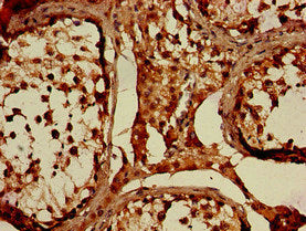 Immunohistochemistry of paraffin-embedded human testis tissue using the antibody at dilution of 1:100Rabbit anti-Human WNK1 Polyclonal Antibody