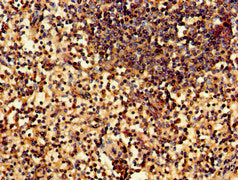 Immunohistochemistry of paraffin-embedded human spleen tissue using WNK1 Antibody at dilution of 1:100Rabbit anti-Human WNK1 Polyclonal Antibody