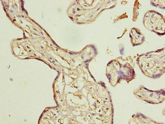 Immunohistochemistry of paraffin-embedded human placenta tissue using ACTL8 Antibody at dilution of 1:100