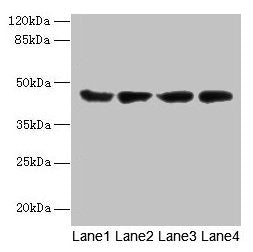 Western blotAll lanes: ACTL8 antibody at 5µg/mlLane 1: Hela whole cell lysateLane 2: HepG2 whole cell lysateLane 3: A549 whole cell lysateLane 4: MCF-7 whole cell lysateSecondaryGoat polyclonal to rabbit IgG at 1/10000 dilutionPredicted band size: 42 kDaObserved band size: 42 kDa