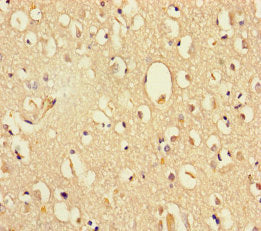 Immunohistochemistry of paraffin-embedded human brain tissue using DHX35 Antibody at dilution of 1:100Rabbit anti-Human DHX35 Polyclonal Antibody