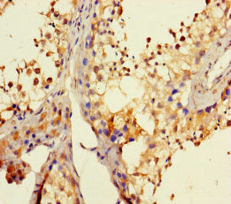 Immunohistochemistry of paraffin-embedded human testis tissue using DHX35 Antibody at dilution of 1:100Rabbit anti-Human DHX35 Polyclonal Antibody