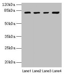 Western blot  | All lanes: DHX35 antibody at 12µg/ml  | Lane 1: Mouse kidney tissue  | Lane 2: Mouse liver tissue  | Lane 3: K562 whole cell lysate  | Lane 4: Hela whole cell lysate  | Secondary  | Goat polyclonal to rabbit IgG at 1/10000 dilution  | Predicted band size: 79, 76 kDa  | Observed band size: 79 kDaRabbit anti-Human DHX35 Polyclonal Antibody