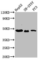 Western Blot  | Positive WB detected in: HepG2 whole cell lysate, SH-SY5Y whole cell lysate, PC-3 whole cell lysate  | All lanes: CXorf36 antibody at 3.9µg/ml  | Secondary  | Goat polyclonal to rabbit IgG at 1/50000 dilution  | Predicted band size: 49, 21 kDa  | Observed band size: 49 kDaRabbit anti-Human CXorf36 Polyclonal Antibody