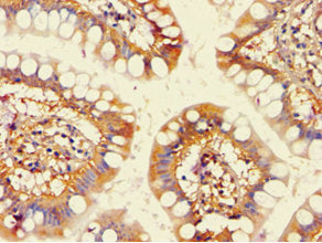 Immunohistochemistry of paraffin-embedded human small intestine tissue using ACAD9 Antibody at dilution of 1:100