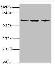 Western blot | All lanes: ACAD9 antibody at 6μg/ml | Lane 1: MCF-7 whole cell lysate | Lane 2: 293T whole cell lysate | Lane 3: K562 whole cell lysate | Secondary | Goat polyclonal to rabbit IgG at 1/10000 dilution | Predicted band size: 69 kDa | Observed band size: 69 kDa