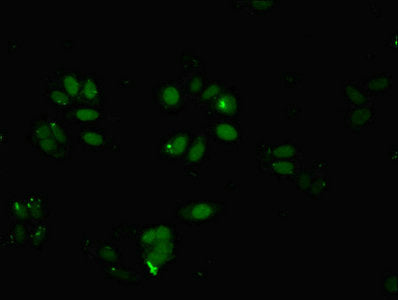Immunofluorescent analysis of HepG2 cells using BRD9 Antibody at dilution of 1:100 and Alexa Fluor 488-congugated AffiniPure Goat Anti-Rabbit IgG(H+L)