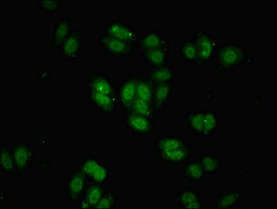 Immunofluorescent analysis of HepG2 cells using BRD9 Antibody at dilution of 1:100 and Alexa Fluor 488-congugated AffiniPure Goat Anti-Rabbit IgG(H+L)