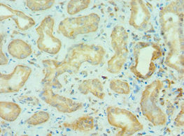 Immunohistochemistry of paraffin-embedded human kidney tissue using BRD9 Antibody at dilution of 1:100