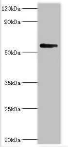 Western blot | All lanes: Bromodomain-containing protein 9 antibody at 2μg/ml + Mouse liver tissue | Secondary | Goat polyclonal to rabbit IgG at 1/10000 dilution | Predicted band size: 68, 23, 54, 27, 56, 61 kDa | Observed band size: 68 kDa