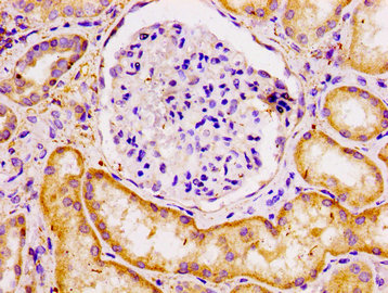 IHC image of the antibody diluted at 1:100 and staining in paraffin-embedded human kidney tissue performed on a Leica BondTM system. After dewaxing and hydration, antigen retrieval was mediated by high pressure in a citrate buffer (pH 6.0). Section was blocked with 10% normal goat serum 30min at RT. Then primary antibody (1% BSA) was incubated at 4°C overnight. The primary is detected by a biotinylated secondary antibody and visualized using an HRP conjugated SP system.Rabbit anti-Human ECT2 Polyclonal Antibody