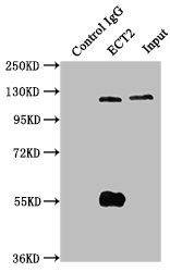 Immunoprecipitating ECT2 in Hela whole cell lysate | Lane 1: Rabbit control IgG instead of ECT2 Antibody in Hela whole cell lysate. | For western blotting, a HRP-conjugated Protein G antibody was used as the secondary antibody (1/50000) | Lane 2: ECT2 Antibody (6μg) + Hela whole cell lysate (1mg) | Lane 3: Hela whole cell lysate (20μg)Rabbit anti-Human ECT2 Polyclonal Antibody