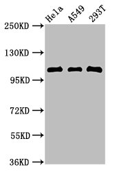 Western Blot | Positive WB detected in: Hela whole cell lysate, A549 whole cell lysate, 293T whole cell lysate | All lanes:ECT2 antibody at 2.7μg/ml | Secondary | Goat polyclonal to rabbit IgG at 1/50000 dilution | Predicted band size: 104, 100, 109, 101 kDa | Observed band size: 104 kDaRabbit anti-Human ECT2 Polyclonal Antibody