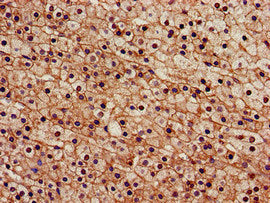 Immunohistochemistry of paraffin-embedded human adrenal gland tissue using SENP2 Antibody at dilution of 1:100