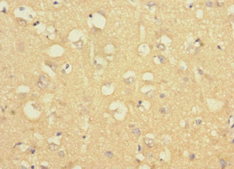 Immunohistochemistry of paraffin-embedded human brain tissue using the antibody at dilution of 1:100