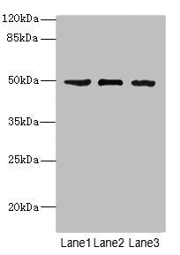 Western blot  | All lanes: CSNK1G1 antibody at 1.13µg/ml  | Lane 1: Jurkat whole cell lysate  | Lane 2: Hela whole cell lysate  | Lane 3: MCF-7 whole cell lysate  | Secondary  | Goat polyclonal to rabbit IgG at 1/10000 dilution  | Predicted band size: 49, 46 kDa  | Observed band size: 49 kDaRabbit anti-Human CSNK1G1 Polyclonal Antibody