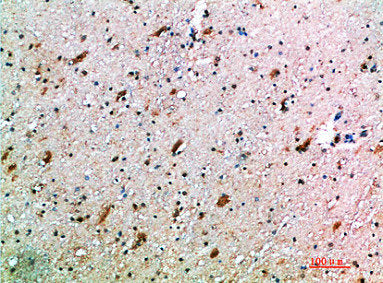 Immunohistochemical analysis of paraffin-embedded human-brain, antibody was diluted at 1:200