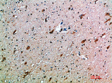 Immunohistochemical analysis of paraffin-embedded human-brain, antibody was diluted at 1:200