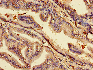 Immunohistochemistry of paraffin-embedded human prostate tissue using ACP6 Antibody at dilution of 1:100