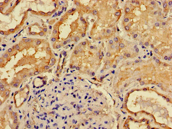 Immunohistochemistry of paraffin-embedded human kidney tissue using ACP6 Antibody at dilution of 1:100