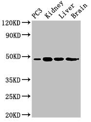 Western Blot | Positive WB detected in: PC-3 whole cell lysate, Mouse kidney tissue, Mouse liver tissue, Rat brain tissue | All lanes: ACP6 antibody at 3μg/ml | Secondary | Goat polyclonal to rabbit IgG at 1/50000 dilution | Predicted band size: 49, 31 kDa | Observed band size: 49 kDa