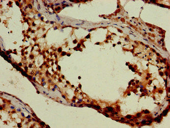 Immunohistochemistry of paraffin-embedded human testis tissue using SLC6A13 Antibody at dilution of 1:100Rabbit anti-Human SLC6A13 Polyclonal Antibody