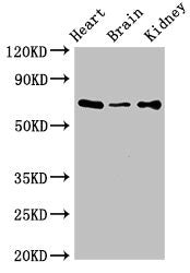 Western Blot | Positive WB detected in: Mouse heart tissue, Mouse brain tissue, Mouse kidney tissue | All lanes: SLC6A13 antibody at 3μg/ml | Secondary | Goat polyclonal to rabbit IgG at 1/50000 dilution | Predicted band size: 69, 58, 11 kDa | Observed band size: 69 kDaRabbit anti-Human SLC6A13 Polyclonal Antibody