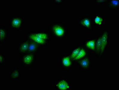 Immunofluorescence staining of HepG2 cells with FAIM Antibody at 1:133, counter-stained with DAPI. The cells were fixed in 4% formaldehyde, permeabilized using 0.2% Triton X-100 and blocked in 10% normal Goat Serum. The cells were then incubated with the antibody overnight at 4°C. The secondary antibody was Alexa Fluor 488-congugated AffiniPure Goat Anti-Rabbit IgG(H+L).Rabbit anti-Human FAIM Polyclonal Antibody