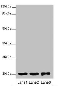 Western blot | All lanes: FAIM antibody at 2μg/ml | Lane 1: 293T whole cell lysate | Lane 2: Rat gonad tissue | Lane 3: Jurkat whole cell lysate | Secondary | Goat polyclonal to rabbit IgG at 1/10000 dilution | Predicted band size: 21, 25, 23 kDa | Observed band size: 21 kDaRabbit anti-Human FAIM Polyclonal Antibody