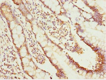 Immunohistochemistry of paraffin-embedded human small intestine tissue using NLE1 Antibody at dilution of 1:100Rabbit anti-Human NLE1 Polyclonal Antibody