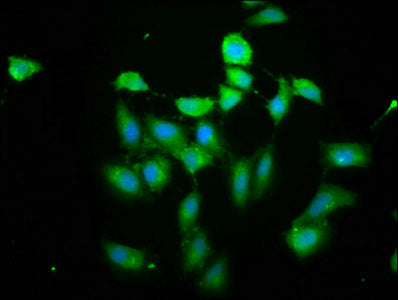 Immunofluorescence staining of Hela cells cells with PIH1D1 Antibody at 1: 200, counter-stained with DAPI. The cells were fixed in 4% formaldehyde, permeabilized tissue using 0.2% Triton X-100 and blocked in 10% normal Goat Serum. The cells were then incubated with the antibody overnight at 4°C.The secondary antibody was Alexa Fluor 488-congugated AffiniPure Goat Anti-Rabbit IgG(H+L) .Rabbit anti-Human PIH1D1 Polyclonal Antibody