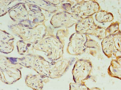 Immunohistochemistry of paraffin-embedded human placenta tissue using the antibody at dilution of 1:100Rabbit anti-Human PIH1D1 Polyclonal Antibody
