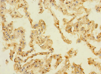 Immunohistochemistry of paraffin-embedded human lung tissue using the antibody at dilution of 1:100Rabbit anti-Human PAQR5 Polyclonal Antibody