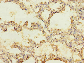 Immunohistochemistry of paraffin-embedded human lung tissue using CACNA2D2 Antibody at dilution of 1:100